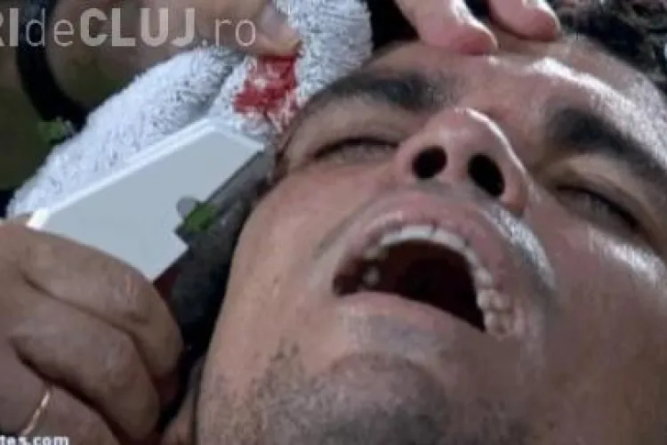 Accidentare horror la meciul lui Real Madrid. Pepe a fost cusut pe viu - VIDEO Imagini șocante