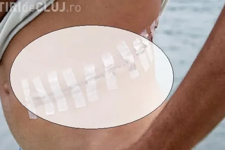 Povestea DURĂ a unui rinichi prelevat la NEGRU la Cluj, care s-a dus la ”străini”. Procurorii nu au făcut nimic de 8 ani?