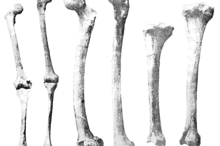 Cea mai inutilă metodă prin care oamenii vor să își întărească oasele. Vezi ce spun expertii