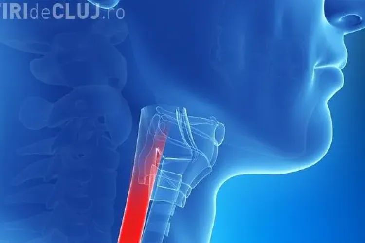 Operație în premieră pentru Europa de Sud-Est realizată la Cluj