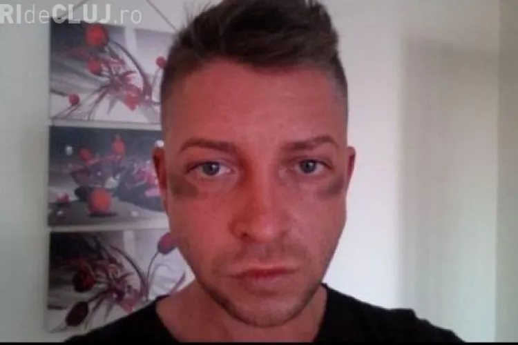 Partenerul de emisiune al lui Bendeac a fost bătut de poliție...din greșeală