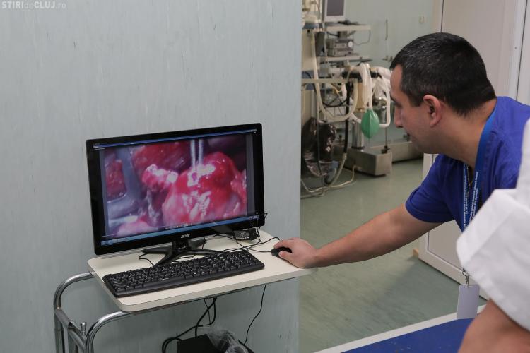 Aparat laser UNIC folosit la Clinica TBC Cluj pentru extirparea metastazelor pulmonare multiple - FOTO