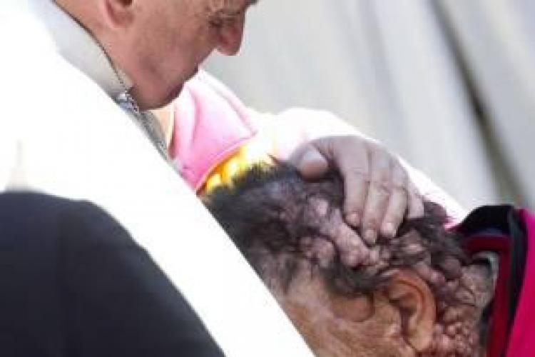 Imaginea ZGUDUITOARE a unui bolnav în brațele Papei Francisc