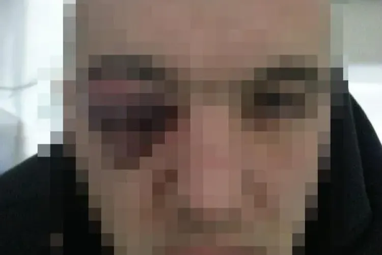 Bătaie la Janis! Doi tineri acuză oamenii de ordine că i-au RUPT în BĂTAIE - FOTO