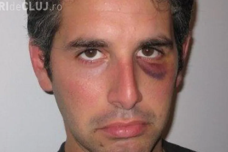 Un turist a fost bătut de proprietarul unei pensiuni de Revelion. Motivul: Turistul nu mai voia manele