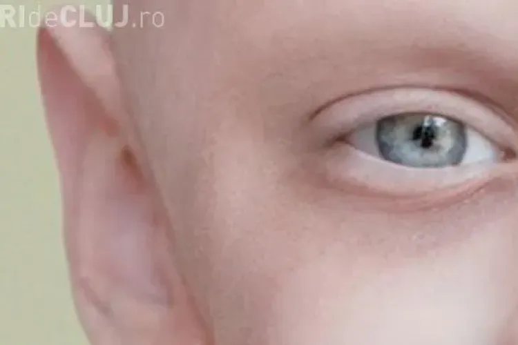 Fotografia unui băiat bolnav de leucemie a emoţionat o lume! Ce mesaj ascunde