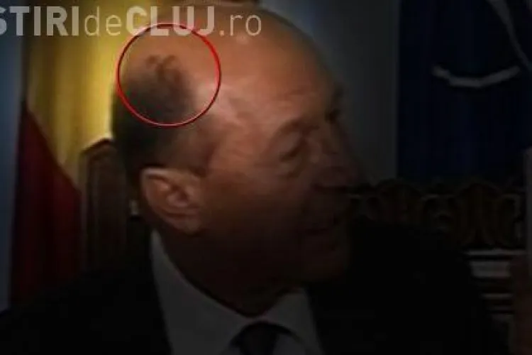 Basescu are pete ciudate pe cap. Este seful statului bolnav? - FOTO