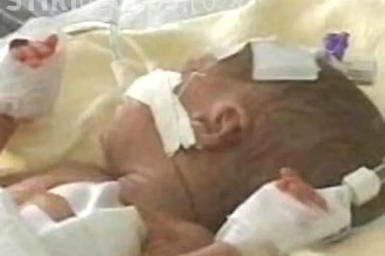 Bebelusul accidentat de fostul prefect de Cluj pe trecerea de pietoni a fost operat si este in stare critica. Mama copilului a fost si ea operata