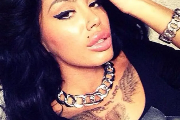 O româncă și-a mărit buzele până când i-au explodat. Voia să semene cu Bianca