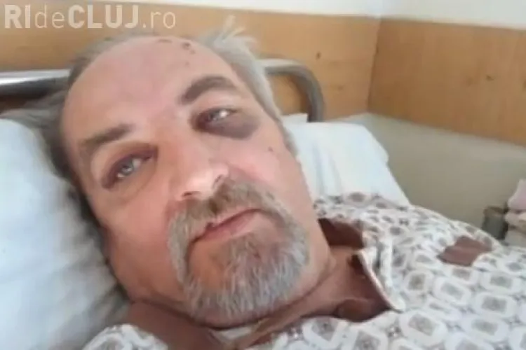 Primarul din Mociu l-a zdrobit în BĂTAIE pe un inginer din Palatca. Poliţia Cluj se mişcă cu încetinitorul