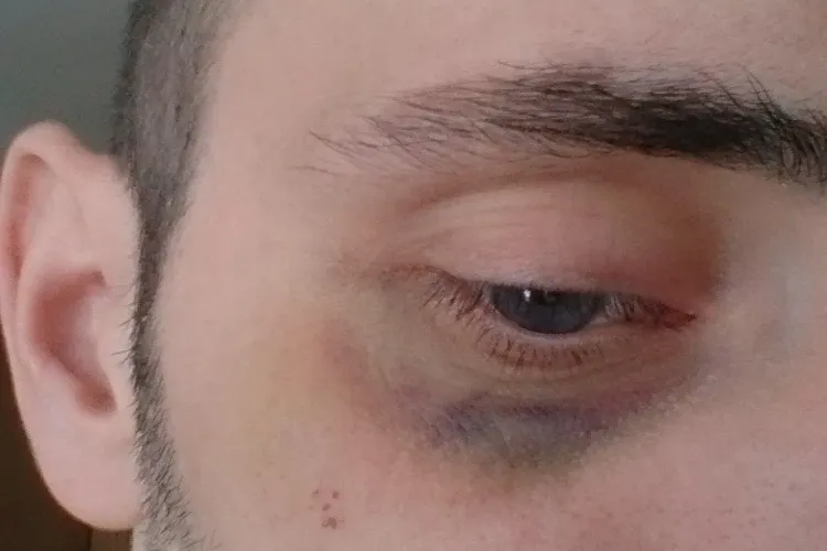 Clujean stabilit în Londra, bătut în Janis de un om de ordine. Ce s-a întâmplat? - FOTO