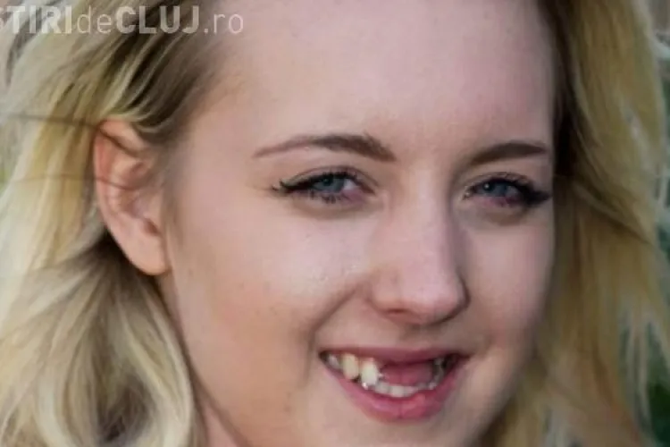 Luni de zile nu a zâmbit după un accident care a lăsat-o fără dinți. Transformarea este majoră după implant