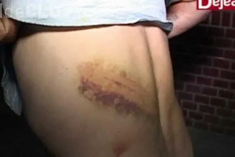 Bărbat bătut cu parul într-o localitate clujeană. A sunat la ambulanță abia după 5 zile VIDEO