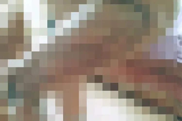 Un clujean s-a dus la spital cu o bătătură la picior, iar medicul i l-a amputat! / UPDATE: Ce spune medicul acuzat?