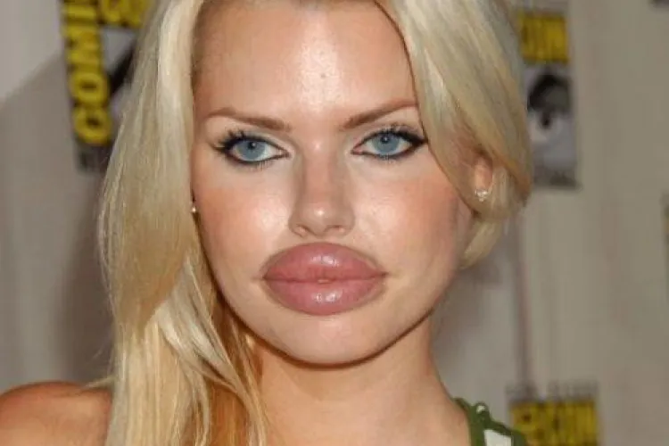 Top OPERAȚII estetice eșuate - FOTO