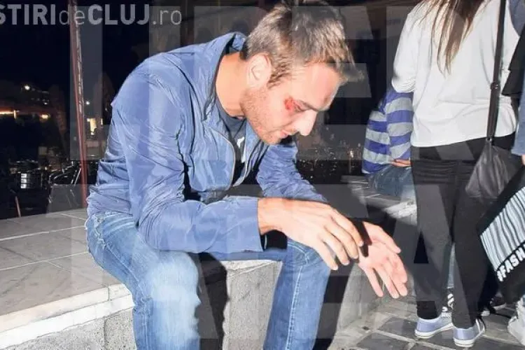 Unul dintre cei mai în vogă artiști din România i-a spart arcada unui fan FOTO