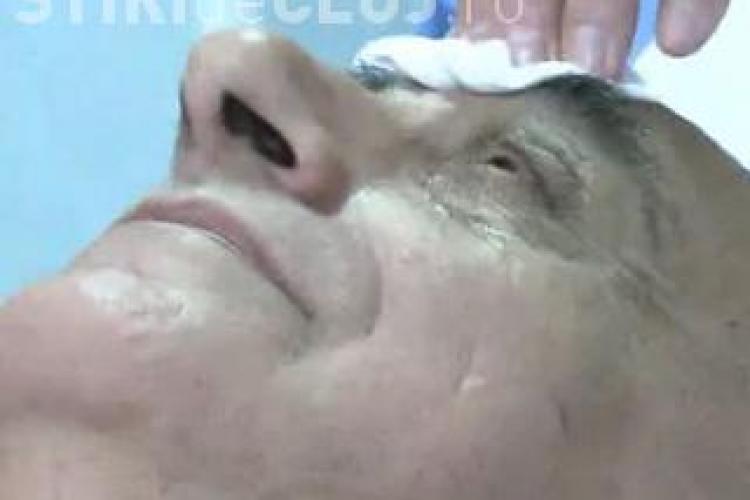 Viorel Lis si-a injectat botox - VIDEO