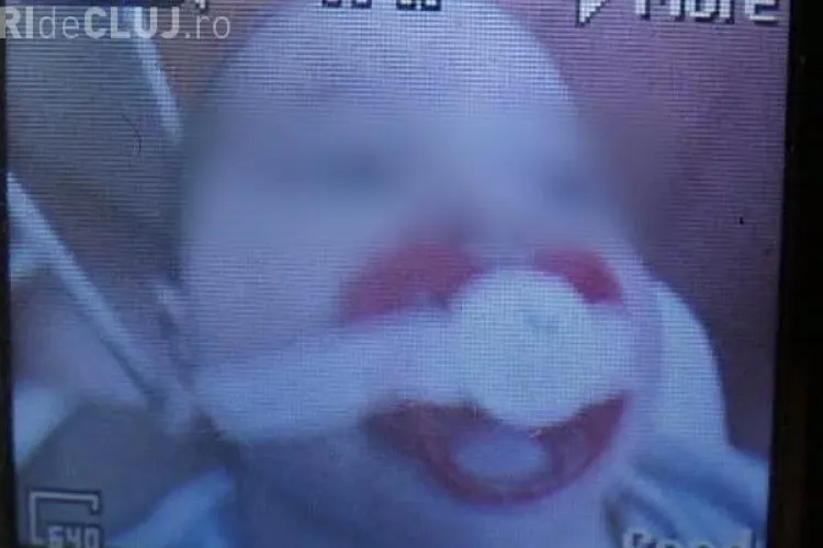 Socant! Gura unui bebelus a fost lipita cu leucoplast pentru a nu striga - FOTO