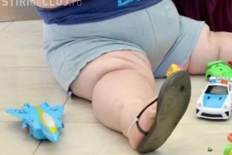 Un copil de 3 ani a ajuns la o greutate ABSURDĂ! Părinții sunt disperați - FOTO