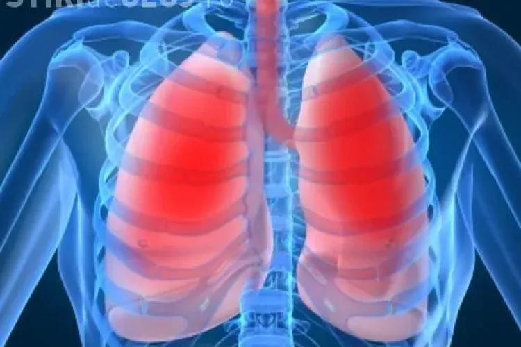 La Cluj se face testare gratuită la plămâni în cadrul unei campanii naționale