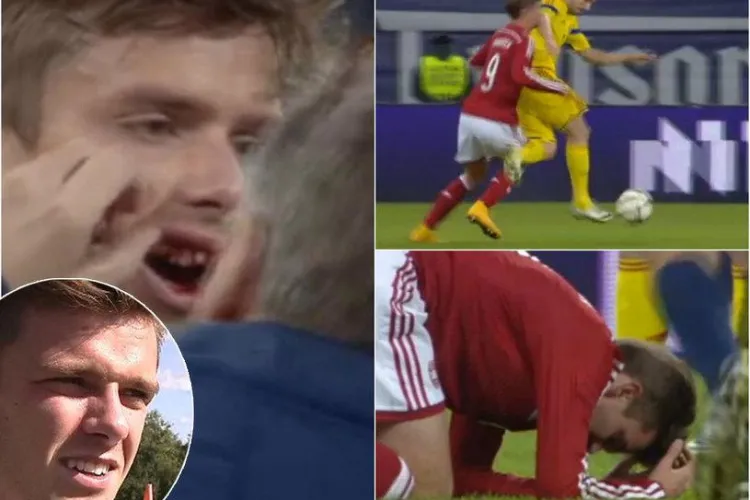 Sânmărtean aproape i-a rupt doi dinți unui danez. L-a lovit cu cotul în figură - FOTO