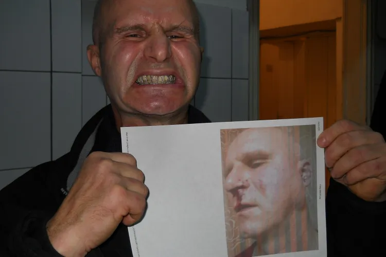 Angajat al primăriei Dej, bătut cu bestialitate în plină stradă. Agresorii au încercat apoi să-l ”îmbuneze” FOTO