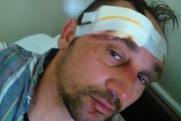 Clujean rupt în bătaie de țigani: Au turnat bere pe mine ca să mă trezesc și să mă mai bată - FOTO