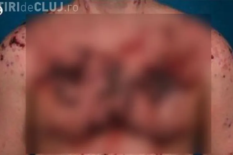 A folosit steroizi și a ajuns să arate așa - FOTO