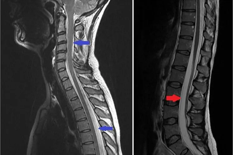 O durea capul când mergea la SALĂ, până când a simtit o pocnitura: Ce i-au spus medicii a ÎNGROZIT-O